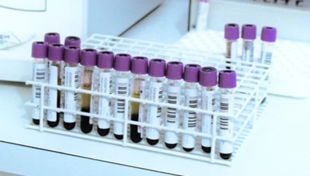 진단업체 현금 곳간 3년새 70% 급감…코로나 특수 여력 고갈